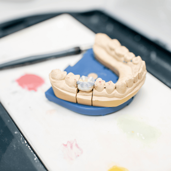 Teeth Replacement Image